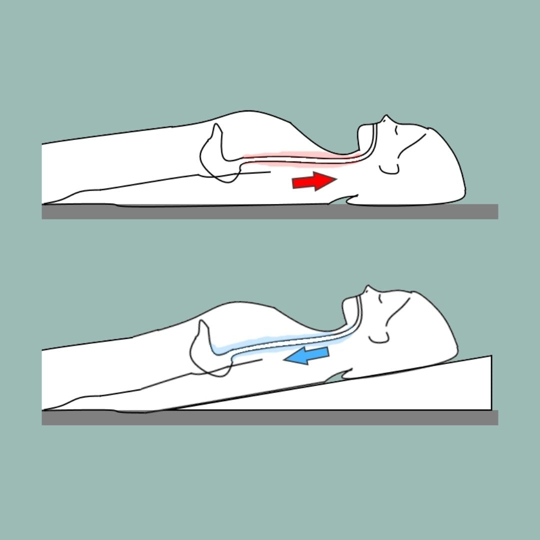 GERD /GORD Bed Wedge - Putnams